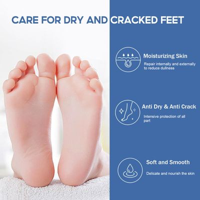 Rosarden Feet Cream for Dry Cracked Feet, 40% Urea Cream, Callus Remover Cream for Feet, Heels, Knees, Elbows, Hand, Moisturizing Foot Cream Softening Rough Skin On Feet, Rough Exfoliates Calloused