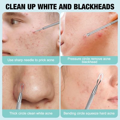 MUIIGOOD 3Pcs Blackhead Remover Pimple Popper Tool Kit Pimple Extractor Acne Treatment Surgical Grade Blackhead Comedone Removal Popper Tool Cleaning Brush for Face Nose Lips