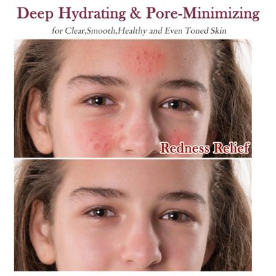 Skin Care Set Kit,Professional Pore Minimizer Skincare for Women Teens Teenager Girls,Hydrate,Oil Control,Smooth Facial Skin Care Products,Travel Skin Care Routine Kit Womens Teen Girl Beauty Gift Set