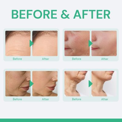 Retinol Cream for Face with Hyaluronic Acid & Collagen - Anti-Aging Daily Moisturizer for Wrinkles, Dry Skin & Neck Firming, Day & Night Cream for Men & Women