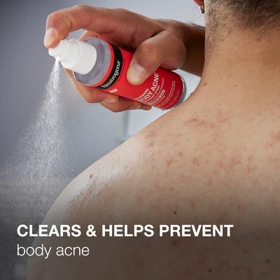 Neutrogena Stubborn Body Acne Spray With Salicylic Acid, Fragrance-Free Spray Acne Treatment to Clear &amp; Help Prevent Acne, Ideal for Chest &amp; Back Breakouts, 2% Salicylic Acid, 5.5 fl. oz