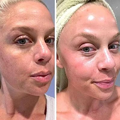 Retinol Gel 0.1 Vitamin A Repairs Fine Lines &amp; Wrinkles, Scar Treatment, Age and Sun Spots, Anti-Aging Formula , 20 Grams