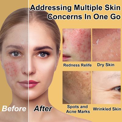 Skin Care Set for Teens Kids Womens Stocking Stuffers,Anti-Aging Deeply Hydrates Repairs Skincare Gift Set for Dry Skin,Facial Skin Care Products Routine Kit Christmas Beauty Gift Set for Women