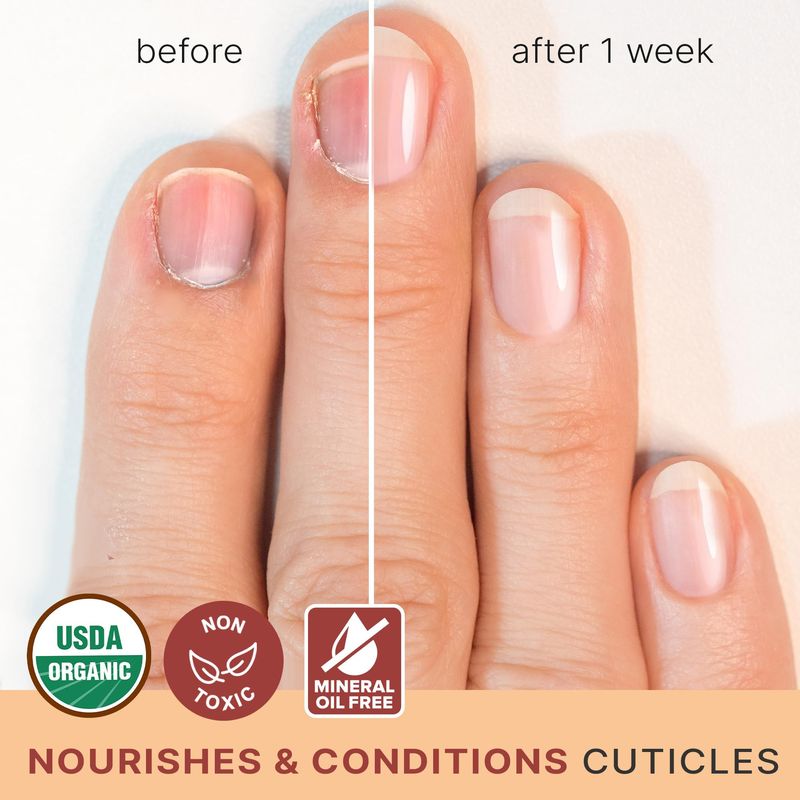 Organic Nail and Cuticle Oil - USA Made Nail Oil for Growth &amp; Strength with Jojoba and Vitamin E, Repair for Damaged Nails &amp; Cuticle Softener made with Natural Ingredients, Nails Care Products