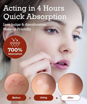 Invisible Spot Pimple Patches for Face, 4H Fast Acting Ultra Thin Discreet Hydrocolloid Acne Treatment with Makeup-Tea Tree, Centella, Madecassoside-Waterproof Zit Cover Pack 110 pcs
