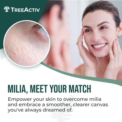 TreeActiv Milia Spot Treatment 3 Items Tool Kit, Pure Eye Milia Remover Treatment, Includes 0.5oz Overnight Milia Remover Cream with Bentonite Clay and Aloe Vera, Milia Extractor Tool Kit Acne Treat