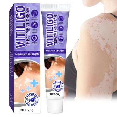 maxboss Vitiligo Treatment, Natural Vitiligo Cream, Effective Improve Skin Pigmentation &amp; Fade Vitiligo1 Pack