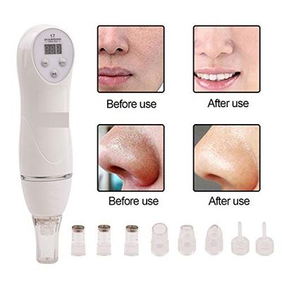 YAVOCOS 6 Tips Blackhead Vacuum Suction Remover Machine Mini Diamond 17 Dermabrasion Skin Peeling Digital Beauty Device Facial Pores Cleaner