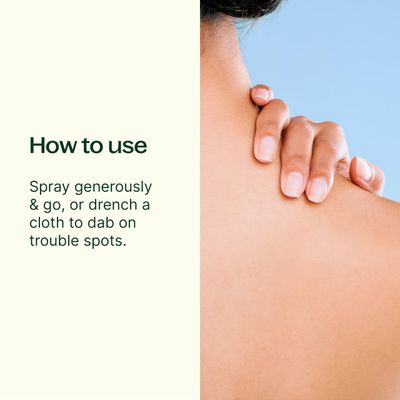 Plant Therapy After Sun Spray 4 oz Instantly Soothes Sunburns, Naturally Supports the Healing Process, Reduces Discomfort from Irritated skin