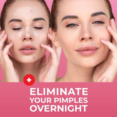 PatchRx Full Face Pimple Patches (5 Sets), Reduce Pimples On Whole Face Overnight, Hydrocolloid Acne Mask, Face Pimple Patches, Large Acne Patches, Full Face Hydrocolloid Mask, Pimple Patches For Face