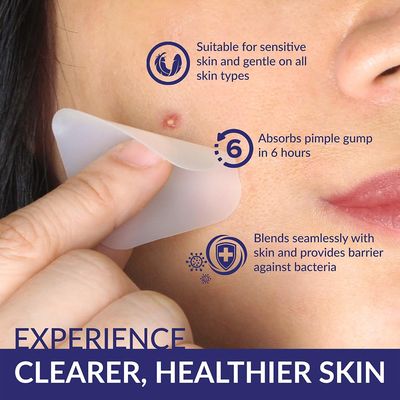 UNNIE SKIN Large Square Acne Pimple Patch Value Pack - Hydrocolloid &amp; Salicyclic acid for clearing pimples, zits, blemishes for face and skin (20 Patches Included, 30 Days Supply)