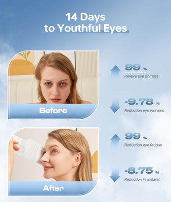 ZHENYEMEI 28 Pack Steam Eye MaskHyaluronic Acid Self Heating Warm Compress for Eyes, Heated Eye Mask for Fast Relief of Dry Eyes, Moisturizing &amp; Highly Effective Steam Eye Mask
