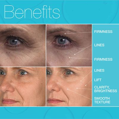 MD Complete Eye Wrinkle Duo | Professional Dermatologist Skin Rejuvenation | includes Wrinkle &amp; Radiance Remedy PLUS with Retinol and Total Eye Treatment with Hyaluronic Acid and Peptides | Set of Two
