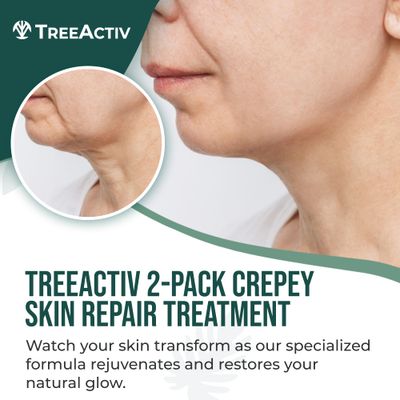 TreeActiv Crepey Skin Repair Treatment, 2-Pack, Firming Cream For Face and Neck, Skin Firming and Tightening Lotion with Hyaluronic Acid, Crepey Skin Treatment to Moisturize Dry Crepe Skin, 1000+ Uses