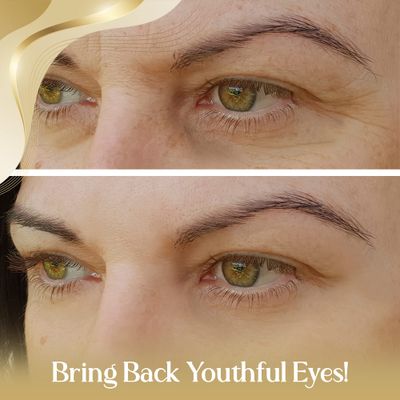 OROGOLD 24K Intensive Eye Serum for Wrinkles, Puffiness - Anti Aging Serum For Youthful Looking Skin - Under Eye Skin Softening Serum - 50 ml. / 1.76 fl. oz.