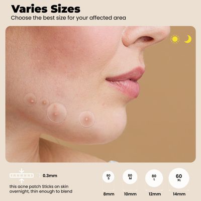 Pimple Patches for Face 300 Counts 4 Sizes by ROSELYNBOUTIQUE - Hydrocolloid Acne Patches with Tea Tree Oil, SalicylicAcid, CICA Skin-Friendly(Package May Vary)