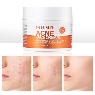 YAFUSIPE Acne Treatment for Face for Hormonal Cystic Stubborn Acne Cream for Sensitive Skin Teens Adults Women Men Spot Pimple Butt Control Rapid Clearing Breakout Overnight