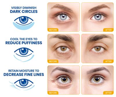 Stylia Under Eye Patches for Puffy Eyes and Dark Circles (20 Pairs), 24k Gold Eye Mask, Eye Mask Skincare, Eye Care for Wrinkles and Puffiness, Collagen Under Eye Masks, Moisturizing Eye Gel Pads