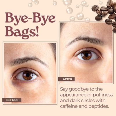 Tree to Tub Caffeine Eye Cream - Hydrating &amp; Firming Under Eye Cream for Dark Circles, Eye Roller for Puffy Eyes, Reduces the Look of Puffiness and Bags, Coffee Eye Cream w/Hyaluronic Acid, Peptides