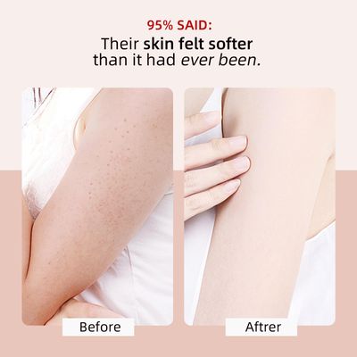 KP Bump Eraser Body Scrub with 10% AHA BHA Ingrown Hair Keratosis Pilaris Razor Bump Treatment Exfoliating Body Scrub Exfoliator Exfoliant Face Scrub for Strawberry Leg Pre-shaven Blackhead 4.23OZ