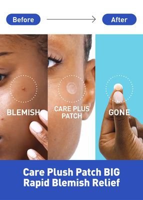 OLIVE YOUNG Care Plus Spot Patch 1 Pack | Hydrocolloid Acne Korean Spot Patch to Cover Zits, Pimples and Blemishes, for Troubled Skin and Face (102 Count - 10mm*72ea + 12mm*30ea)