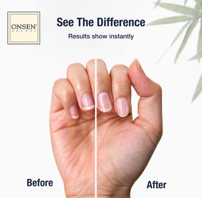 Onsen Nail &amp; Cuticle Cream Treatment w/Japanese Tsubaki, Jojoba &amp; Lavender Oil, Shea Butter - Strengthens Nails, Softens Cuticles - Daily Repair Care (1 Count/15 ml)
