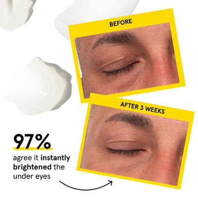 Lumin - Men's Dark Circle Defense Balm - Anti-Aging Korean Formulated Eye Cream Treatment for dark circles, fine lines, & wrinkles, Suitable for all skin types, Daily Use, 20ml, 1-Pack