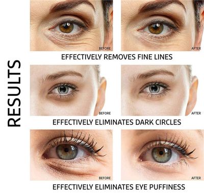 Ruzzut Under Eye Patches - 30 Pairs 24K Gold Moisturizing Under Eye Mask, Anti Aging Collagen Eye Masks Skincare Eye Patches for Puffy Eyes and Dark Circles, Gold