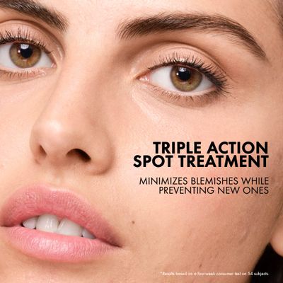 Vichy Normaderm S.O.S Acne Rescue Spot Corrector, 10% Sulfur & Glycolic Acid & Niacinamide, Blackhead Remover & Acne Spot Treatment For Face, Helps Clear & Prevent, Paraben & Oil Free