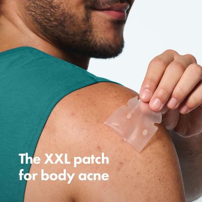 Mighty Patch Hero Cosmetics Body Patch- The XXL Hydrocolloid Patch for Bacne, Chestne, and Other Body Breakouts. Derm-Tested. Medical-Grade Hydrocolloid. Absorbs Pimple Gunk in 6-8 Hours. 4ct