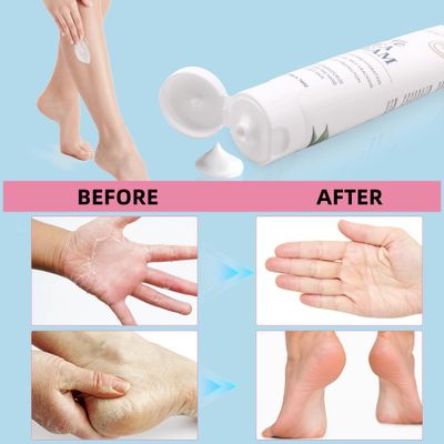 Zegrox Urea Cream 40 Percent for Feet Maximum Strength, Urea Foot and Hand Cream with Powerful Hydration for Dry Skin, Cracked Heels, Deeply Moisturizing for All Skin Types 1.76oz