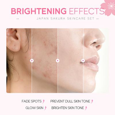 Skincare Gifts For Teenage Girls,Cherry Blossom Skincare Sets,Facial kit,Pamper Sets For Women Gifts,Skin Care Sets & Kits (One Size, Cherry Blossom-SetA-Base Moisturizing)