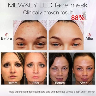 NEWKEY Blue light Therapy Mask for Face Acne, 7 Colors LED Acne Scar Spots Light Therapy Treatment with Silicone Eye Protector for Acne Prone Sensitive Skin and Blemishes Prevention,Plug-in
