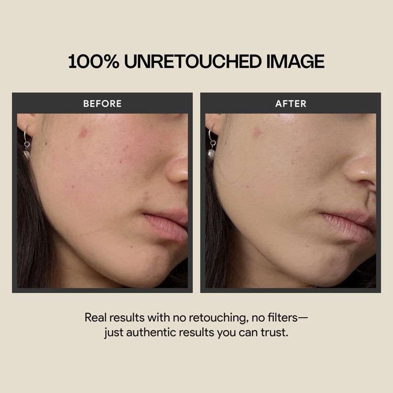 Meebak Cica Redness Solution Cream Lite | Redness Relief | Green Color-Corrector | CC Cream w/Niacinamide | Tinted Moisturizer - Fair to Medium Skin