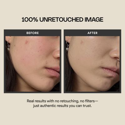 Meebak Cica Redness Solution Cream Lite | Redness Relief | Green Color-Corrector | CC Cream w/Niacinamide | Tinted Moisturizer - Fair to Medium Skin