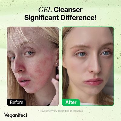 VEGANIFECT Gel Cleanser, Gentle Exfoliation and Face cleanser for Sensitive Skin, Korean Skin Care, Vegan, 6.93 Fl Oz