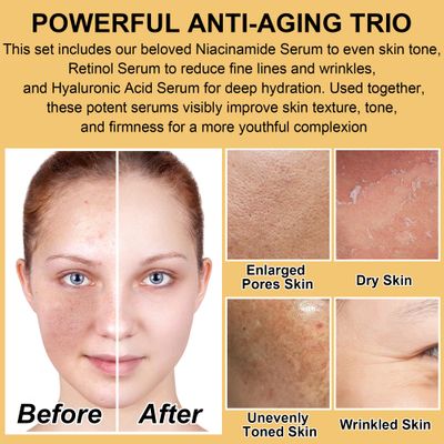 Professional Anti-Aging Skin Care Set Kit,Niacinamide Retinol Serum,Hylunaric Acid Serum,Skincare Gift Set,Facial Skin Care Products,Face Skin Care Routine Kit Christmas Gift for Women Teens