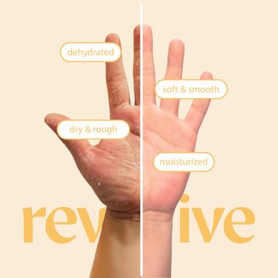 Original Derma Beauty Hand mask 12 Pairs Restoring Cica + Moisturizing Vitamin E Hydrating Hand Mask Hand Mask Gloves (Assort #1) Hand Repair Gloves Hand care Hand Rejuvination Soothing Gloves