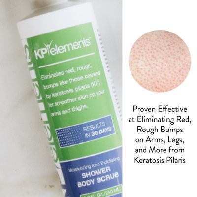 KP Elements Body Scrub (8 fl oz) | Keratosis Pilaris Treatment | Exfoliating Body Scrub and Body Moisturizer for Dry Skin | Helps Reduce Red Bumps | Body Skin Care Product for Men and Women