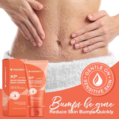 KP Bump Eraser Body Scrub, Bump Eraser Body Scrub, Keratosis Pilaris Treatment, Strawberry Legs Treatment For Women, Kp Bump Eraser, Kp Body Scrub, Exfoliating Body Scrub for Women &amp; Men Exfoliation