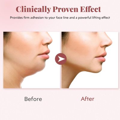 Reusable V-Line Mask, Chin Strap For SleepingLifting EffectAdjustableEasy To Use, Jawline Shaper Face Strap