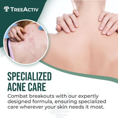 TreeActiv Body &amp; Back Acne Treatment Original Formula, 8 fl oz, 2% Salicylic Acid Spray, Cystic Acne Treatment, Body Acne Spray, Chest, Shoulders &amp; More, Bacne Spray for Teens &amp; Adults