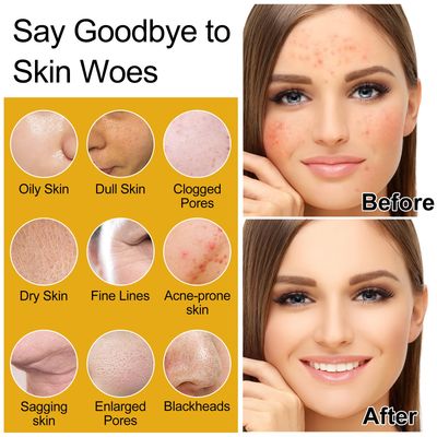 Womens &amp; Teens Wife Christmas Gift Ideas,Skin Care Set,Professional Hydrate Glow Repair Anti-Aging Rice Water Facial Skin Care Routine Kit,Skincare Gift Set for Teenage Girl Womens Gifts for Christmas