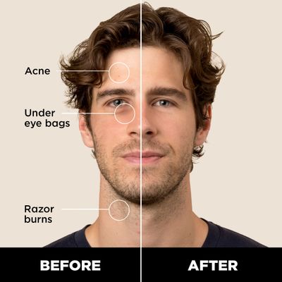 Stryx Concealer Stick Tool for Men, Light Cognac - Natural Pigments Hides Imperfections, Acne, Razor Burns, Scars, &amp; Rosacea - Highly Adaptable Shades for Easy, Undetectable Coverage - All Skin Tones