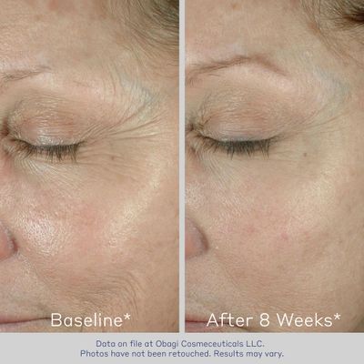 Obagi ELASTIderm Eye Cream - Lightweight, Smooth Formula Clinically Proven to Help Reduce the Appearance of Fine Lines &amp; Wrinkles - 0.5 oz