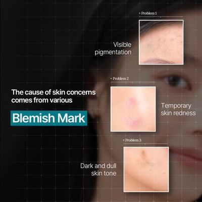 Mediheal Madecassoside Essential Sheet Mask Blemish Repair 10 pcs. 98% Purity Madecassoside &amp; Hyaluronic Acid Included. Enhancing Moisture Barrier &amp; Skin Texture Care. Vegan Formula Sheet Mask