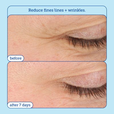 Skinfix Barrier+ Triple Lipid-Boost 360 Eye Cream: Targets Dark Circles, Puffiness, and Fine Lines Around Eyes and Lids, Clinically Proven to Brighten and Refresh Eyes, 0.5 oz