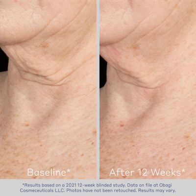 Obagi ELASTIderm Neck &amp; Dcollet Lifting Concentrate with Patented Bi-Mineral Contour Complex, Retinoid &amp; Alpha-Arbutin Clinically Proven to Reduce Fine Lines &amp; Wrinkles - 2 oz