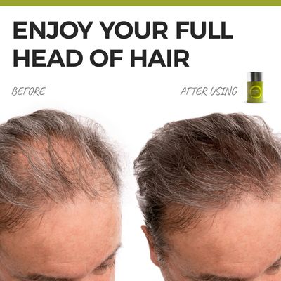 Hair Fibers for Thinning Hair - Natural Keratin Protein Hair Thickening Spray - Hair Fibers for Wavy, Curly, Coiled and Tightly Coiled Hairs - Hair Thickening Products for Women and Men