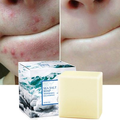 Soap with Sea Salt Natural Goat&#39;s Milk for Face Dry and Natural Oily Skin, Remove Acne Anti-cellulite Soap (3.52 Oz)